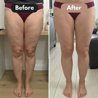 Pevoraa Anti Cellulite Sculpt Leggings